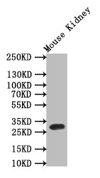Anti-TPSB2 Recombinant Monoclonal, clone 9H6