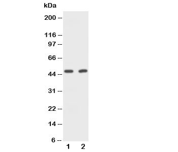 Anti-CD2