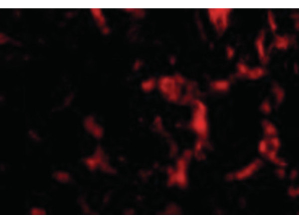 Anti-Wnt10a