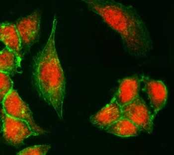 Anti-KDM6A