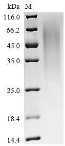 Metal cation symporter ZIP14 (SLC39A14), partial, human, recombinant