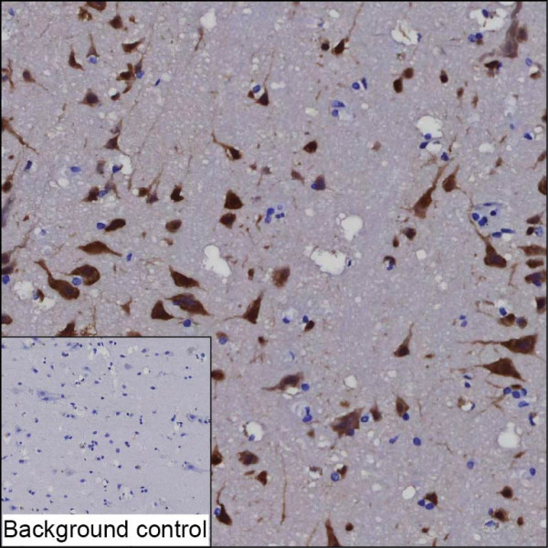 Anti-CELF4