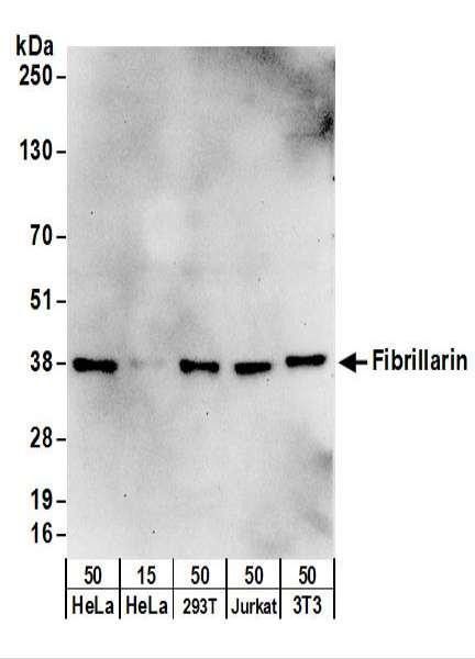 Anti-Fibrillarin
