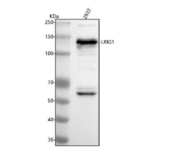 Anti-LRIG1 / Leucine-rich repeats and immunoglobulin-like domains protein 1
