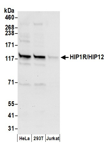 Anti-HIP1R/HIP12
