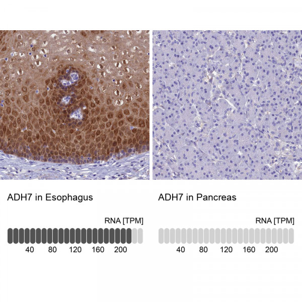 Anti-ADH7