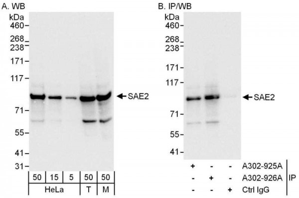 Anti-SAE2