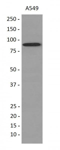 Anti-UBA2 / SAE2