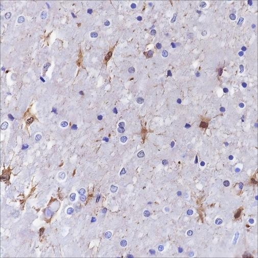 Anti-Recombinant S100A13, clone A353