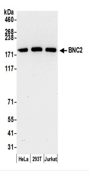 Anti-BNC2
