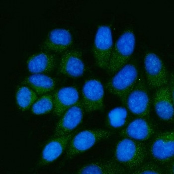 Anti-GDP-L-fucose synthase / GFUS / TSTA3