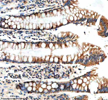 Anti-NUDT8 / Nudix hydrolase 8