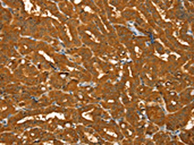 Anti-PYGM