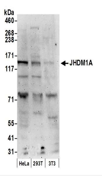 Anti-JHDM1A