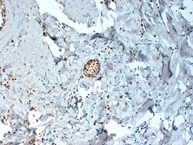 Anti-Estrogen Receptor alpha, clone 6F11