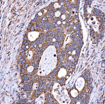 Anti-RAB7A / Ras-related protein Rab-7a