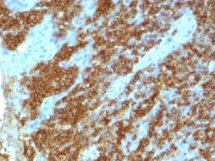 Anti-CD45RA