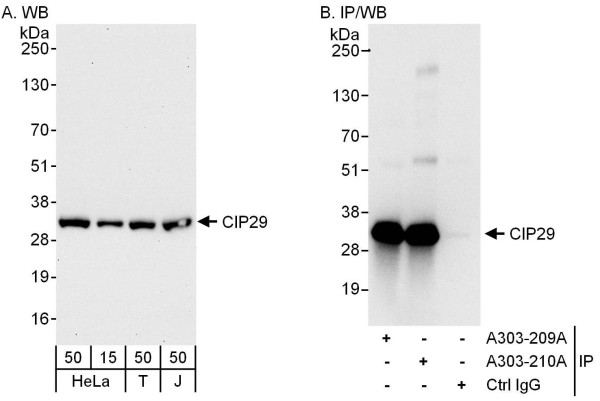 Anti-CIP29