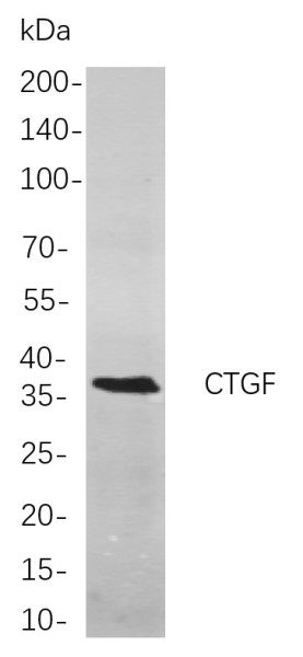 Anti-Recombinant CTGF, clone 7F11