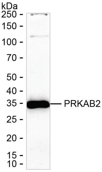 Anti-PRKAB2
