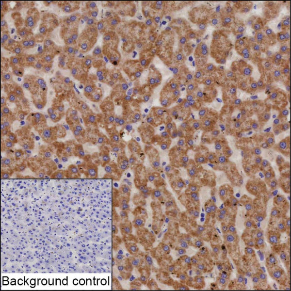 Anti-Sterol carrier 2