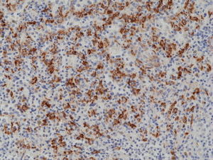 Anti-CD163 (human), Rabbit Monoclonal (RM371)