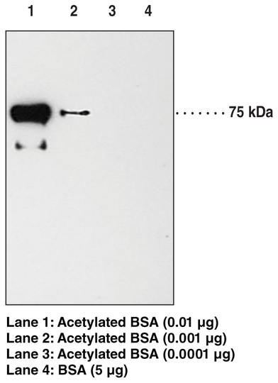 Anti-Acetyl Lysine (Clone 7F8)