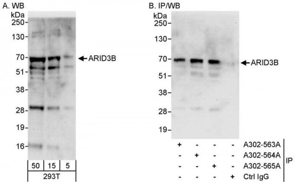 Anti-ARID3B