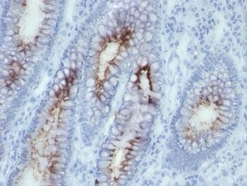 Anti-CEA (Carcinoembryonic Antigen), clone SPM506