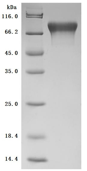 Cell adhesion molecule 1 (Cadm1), partial (Active), mouse, recombinant