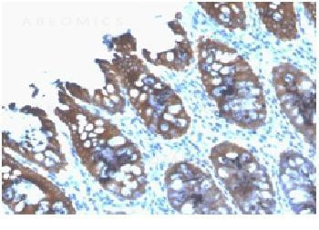 Anti-Cytokeratin 8 (KRT8) Recombinant Mouse Monoclonal Antibody (clone:rB22.1)