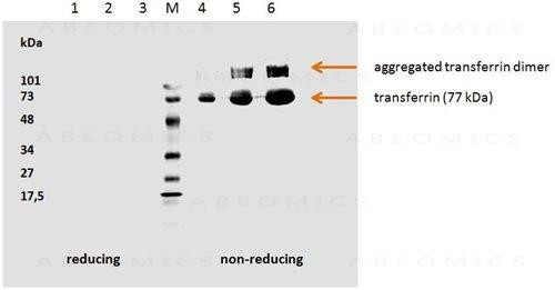 Anti-Transferrin Monoclonal Antibody (Clone:HTF-14)