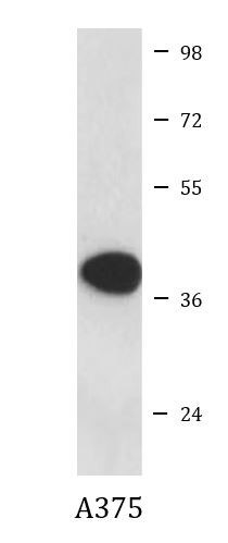 Anti-Cathepsin B