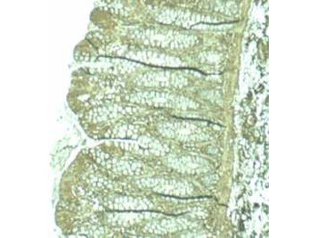 Anti-Pdcd4
