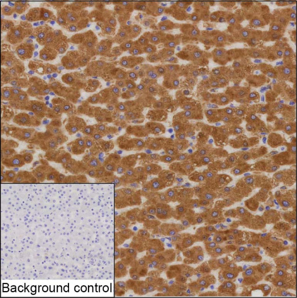 Anti-HSD11B1