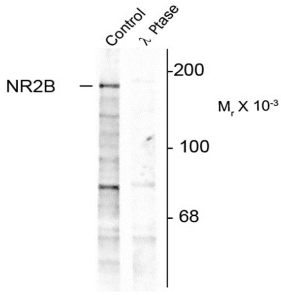 Anti-phospho-NMDAR2B (Tyr1252)
