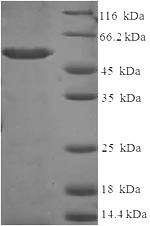 Aldo-keto reductase family 1 member C2 (AKR1C2), human, recombinant