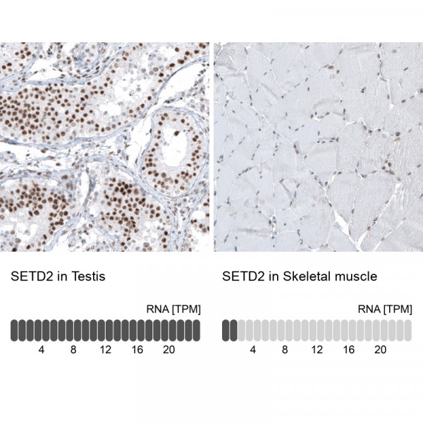 Anti-SETD2, clone CL9956