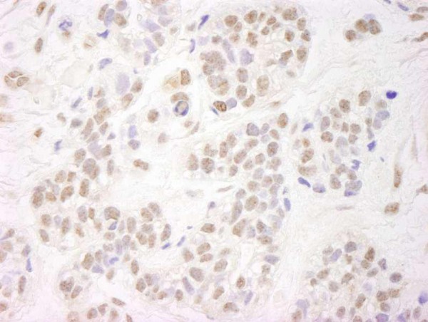 Anti-NELFA (IHC)