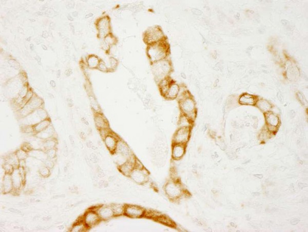 Anti-PKD2 (IHC)