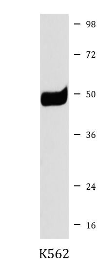 Anti-TACR1 / Neurokinin 1 Receptor