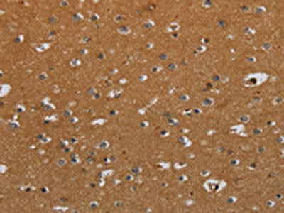 Anti-CSH1