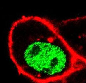 Anti-CDC73 / Parafibromin