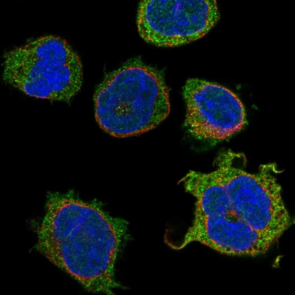 Anti-KCNQ1