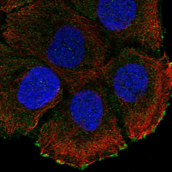 Anti-ATP2C2