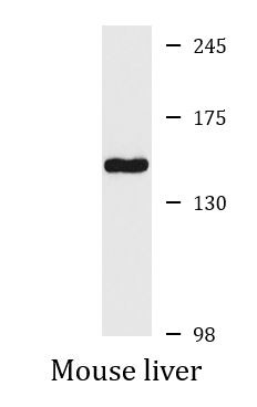 Anti-PMCA2