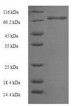 Notchless protein homolog 1 (NLE1), human, recombinant