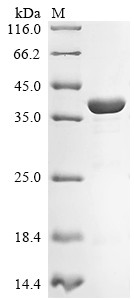 Cyclic AMP-dependent transcription factor ATF-5 (Atf5), mouse, recombinant