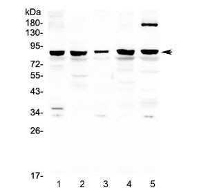 Anti-CARS / Cysteinyl-tRNA synthetase