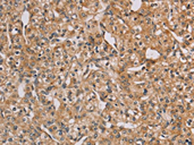 Anti-CHRNA4